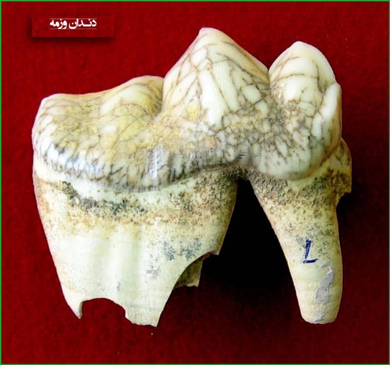 دندان آسیای کودک 9 ساله به نام وزمه در موزه ایران باستان تهران 